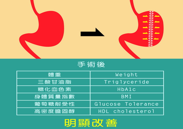 嚴重肥胖的病人在接受縮胃手術後，糖尿病的症狀和許多相關的生化指標都可以得到顯著改善。（圖／撰稿團隊自行設計）