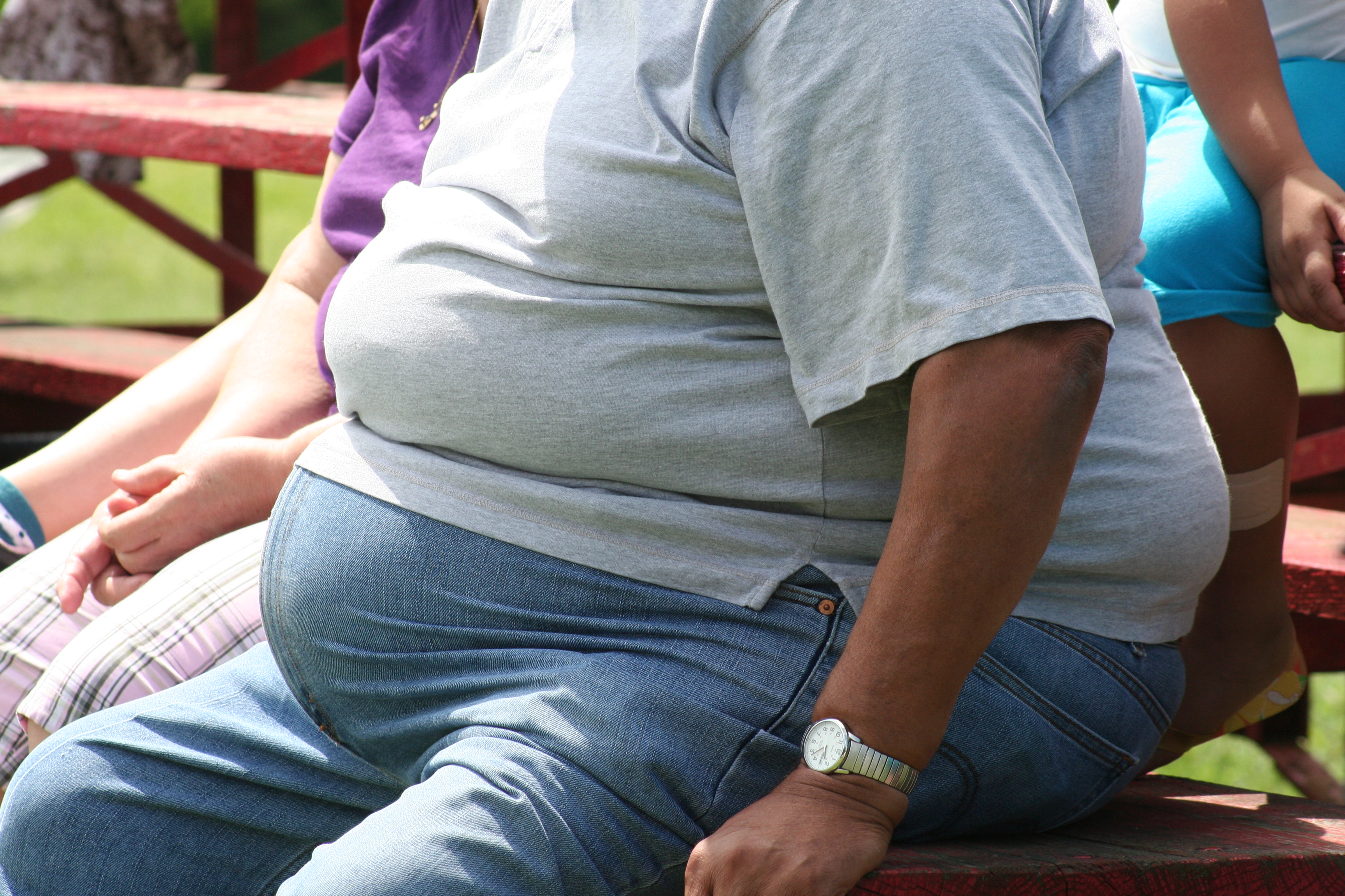 嚴重型肥胖（Severe obesity）的患者，肥胖基因對其所造成的效應可能大於環境效應（圖片來源：Tony Alter，www.welovecostarica.com）。