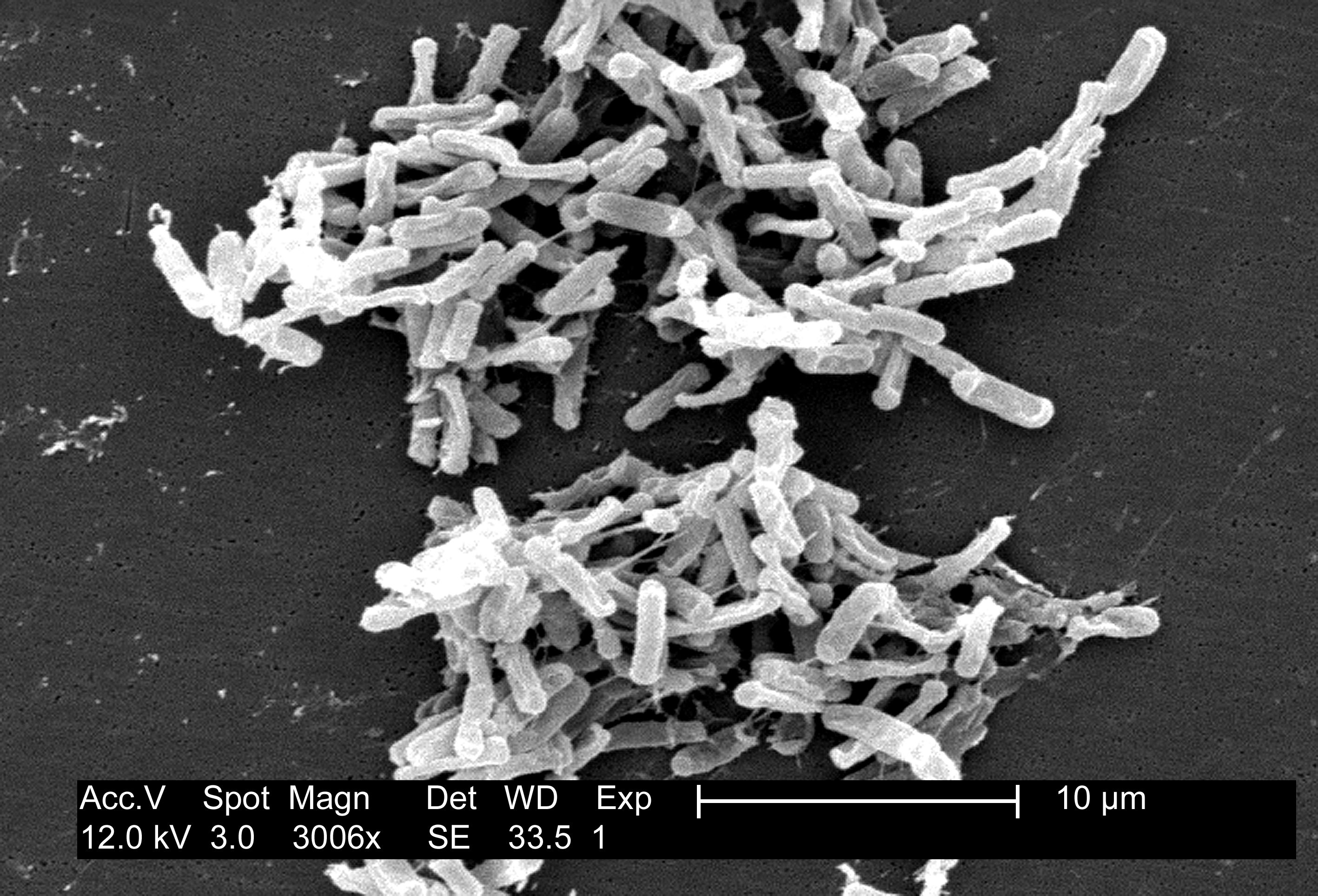 顯微鏡下的困難梭狀桿菌（Clostridium difficile）。（圖／Wikimedia）