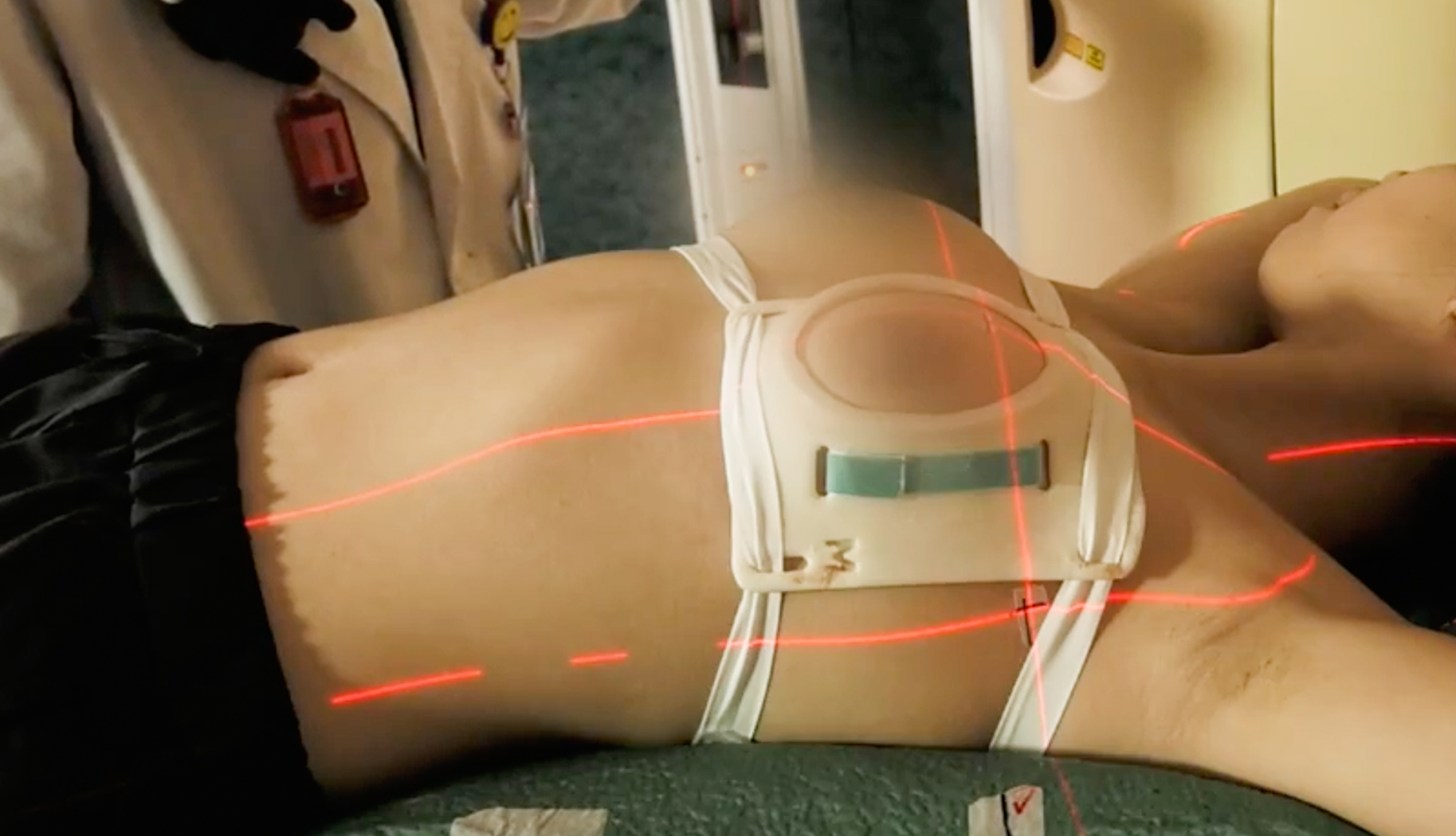 「PERSBRA」幫助乳癌患者進行放射性治療時,集中、托高、固定乳房位置,以有效減少心肺接收到不必要的放射線。(圖片來源:嘉存生醫)