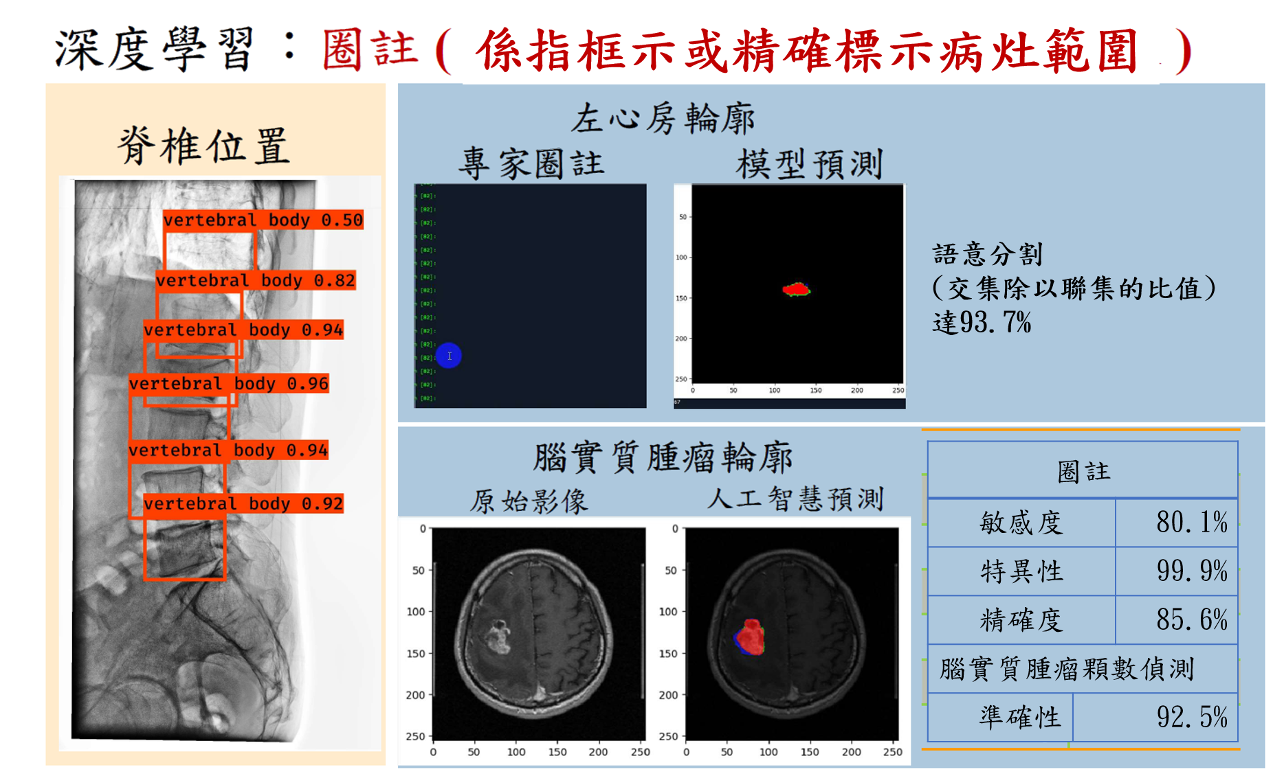 經由人工智慧自動判讀系統，能將AI的判讀結論做為醫師治療策略擬定的參考。(圖片來源：計畫團隊提供)