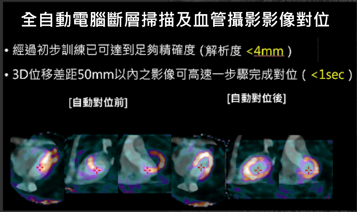 在第一年的AI訓練，完成了核醫心肌灌注掃描與冠狀動脈電腦斷層影像的全自動對位程式未來將持續整合與研發。（圖 / 計畫團隊提供）