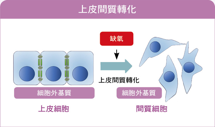 上皮間質轉化：當癌細胞在缺氧的環境下，細胞會進行一系列的上皮間質轉化，細胞型態因此由上皮細胞轉化為具有移動與侵入能力的間質細胞。