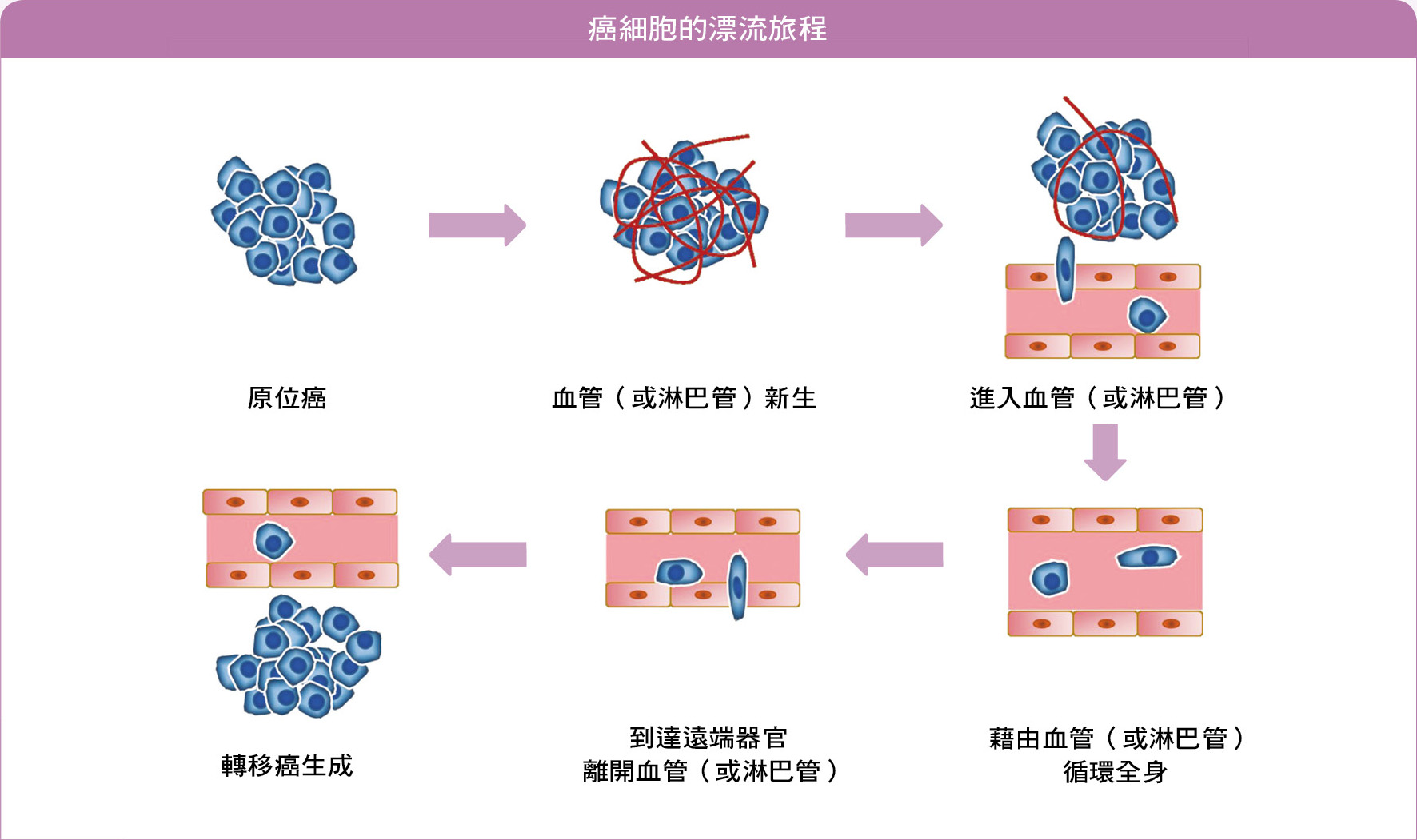 癌細胞的漂流旅程