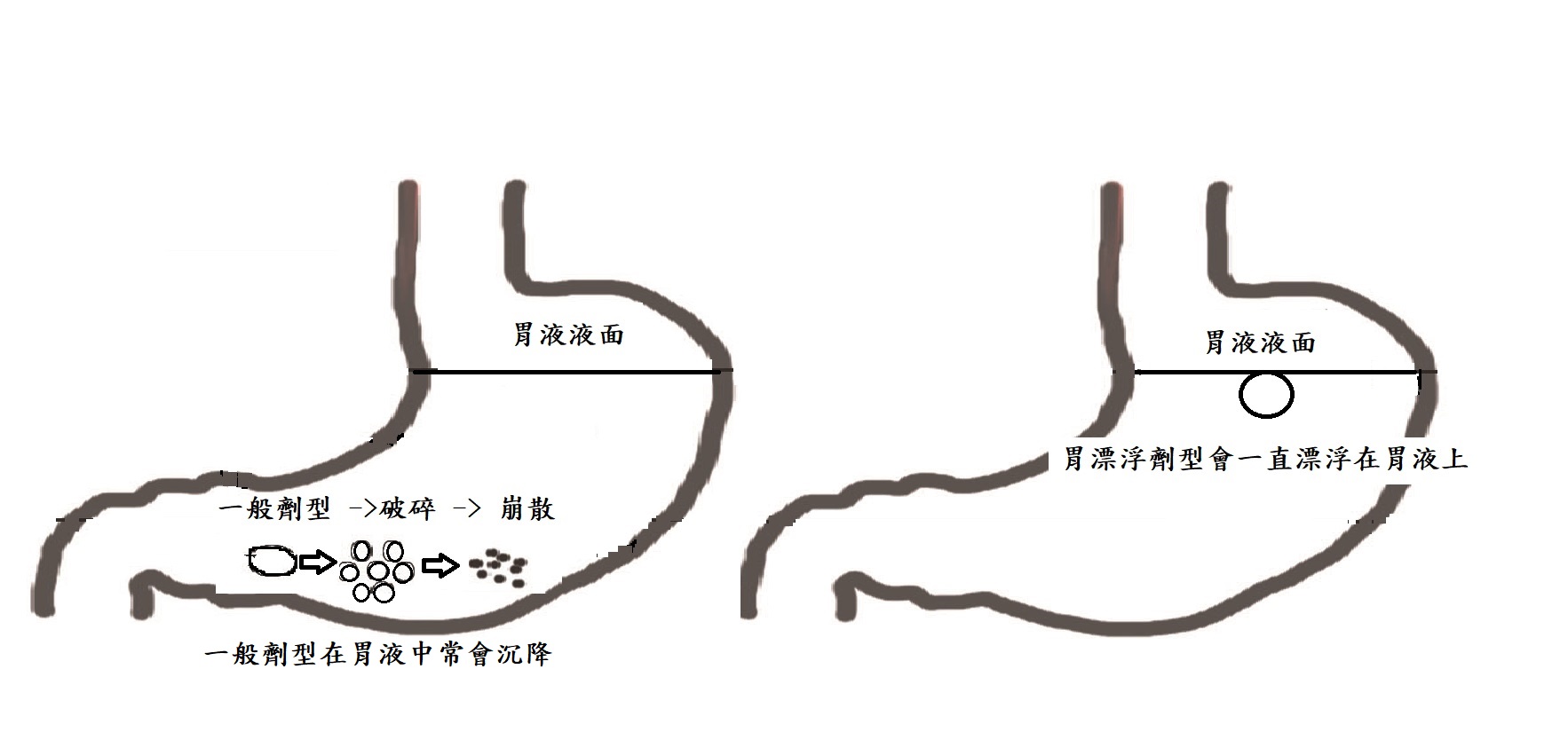 藥物進入胃部示意圖。一般劑型會在消化系統中分裂成較小的顆粒，而胃漂浮劑型則會漂浮在胃液上，延長藥物的作用時間，達到較好的療效。（圖／余建志繪製）
