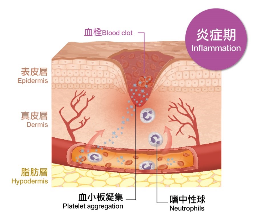 炎症期藉由血小板活化，於受傷部位協助血液凝固形成血栓，讓血塊填塞傷口，嗜中性球由微血管滲出，協助建立適合纖維母細胞增生的區域。（圖／國立科學工藝博物館提供）