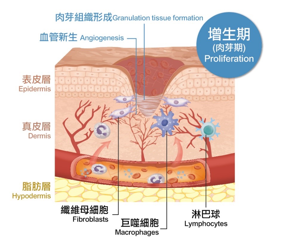 增生期的填補工作由巨噬細胞、纖維母細胞和淋巴球共同完成。首先由巨噬細胞指揮纖維母細胞和血管增生，提供傷口癒合所需營養及氧氣，並利用纖維母細胞分泌膠原蛋白組成肉芽組織；淋巴球則會過濾病毒，協助肉芽組織生長。（圖／國立科學工藝博物館提供）