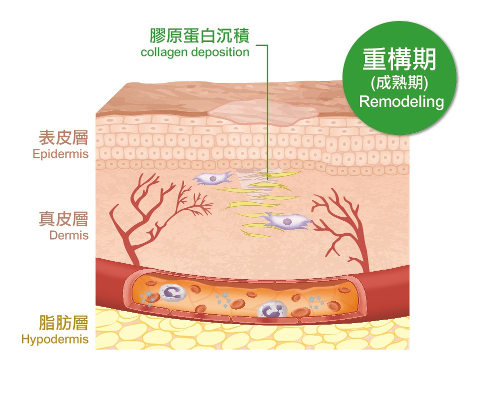 重構期不斷重新排列組合膠原組織，利用膠原蛋白沉積重構傷口。（圖／國立科學工藝博物館提供）