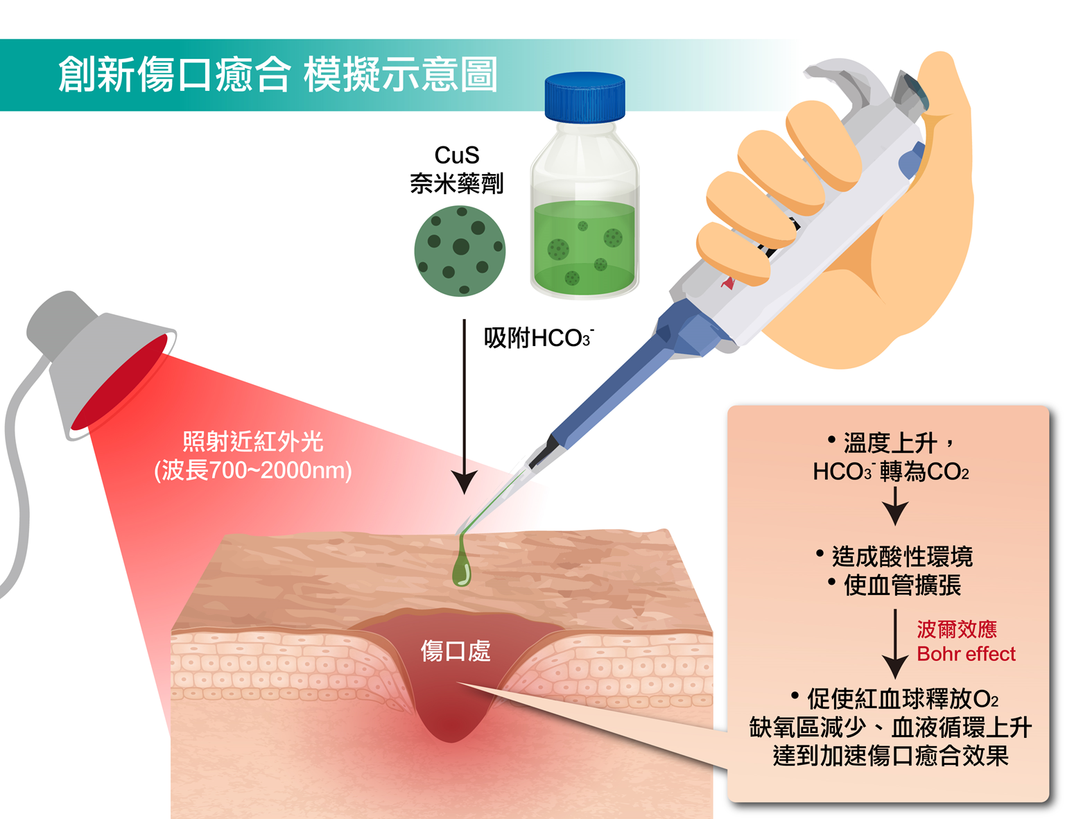 硫化銅粒子吸附小蘇打粒子，透過近紅外光照射，小蘇打粒子遇熱產生二氧化碳，傷口環境轉變成弱酸性，觸發波爾效應，提高傷口氧氣濃度，加速傷口癒合。（圖／國立科學工藝博物館提供）