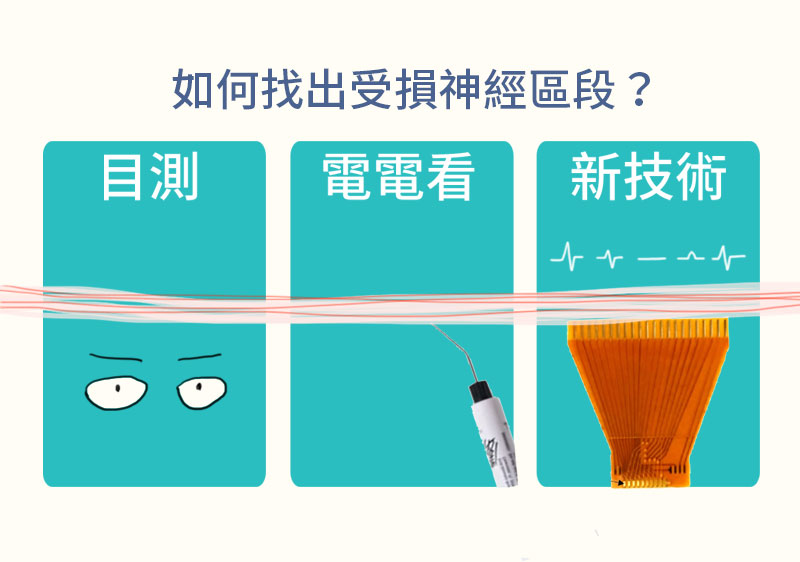 裴育晟的研究成果幫助醫師精確找出神經受損的區段。（圖／孔瀞慧）
