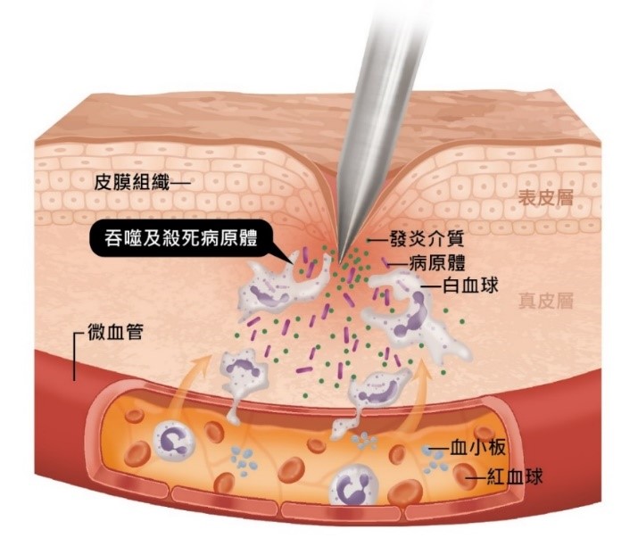 當病原體通過表皮層入侵至真皮層，白血球會附著於血管壁，增加局部血管滲透性，造成血漿外滲至傷口組織，釋出更多白血球吞噬病原體。 （圖／國立科學工藝博物館提供）