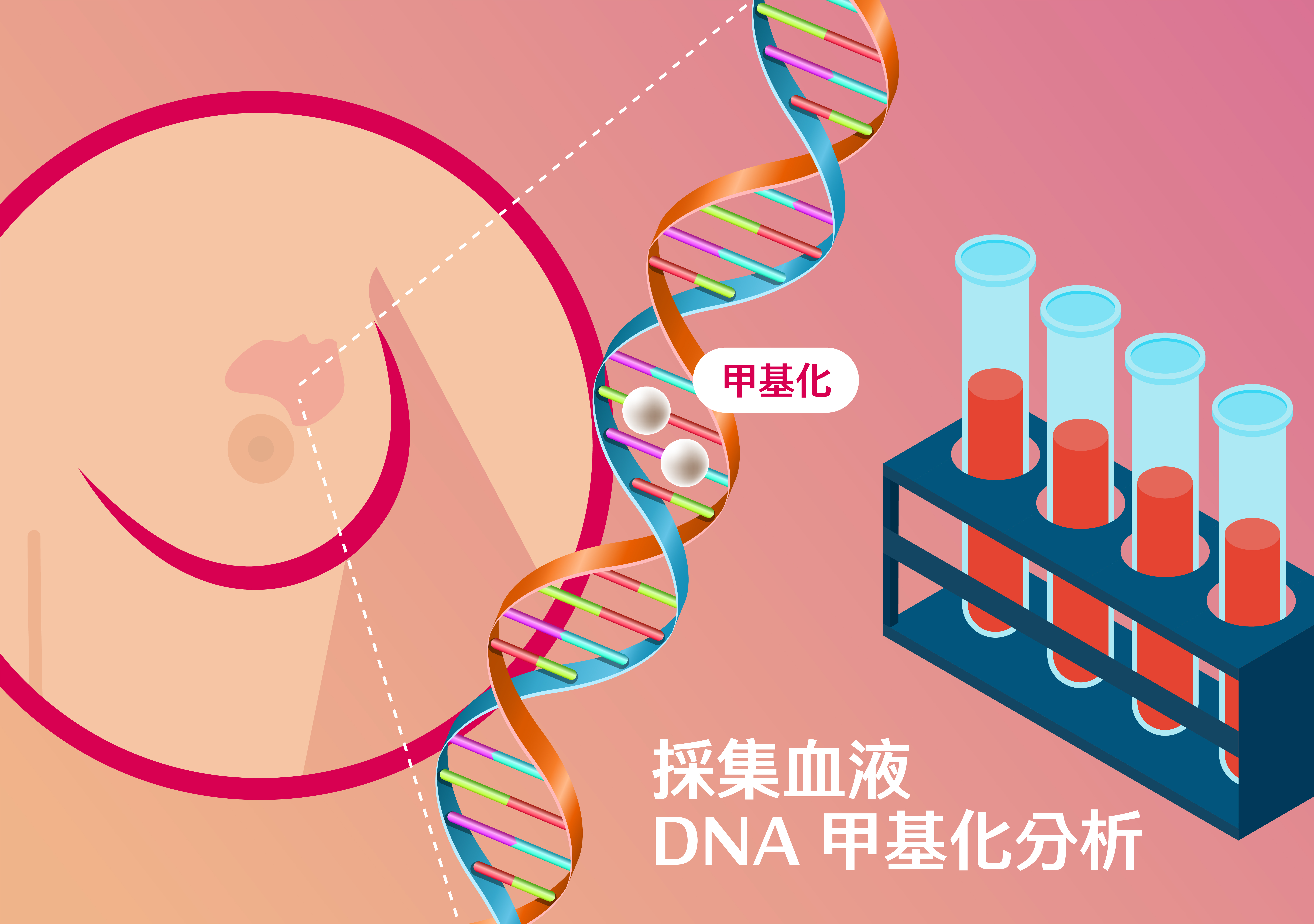 林若凱團隊研發成果：透過採集血液，分析DNA甲基化情形，就能檢測是否罹患乳癌。（圖／何庭劭繪）