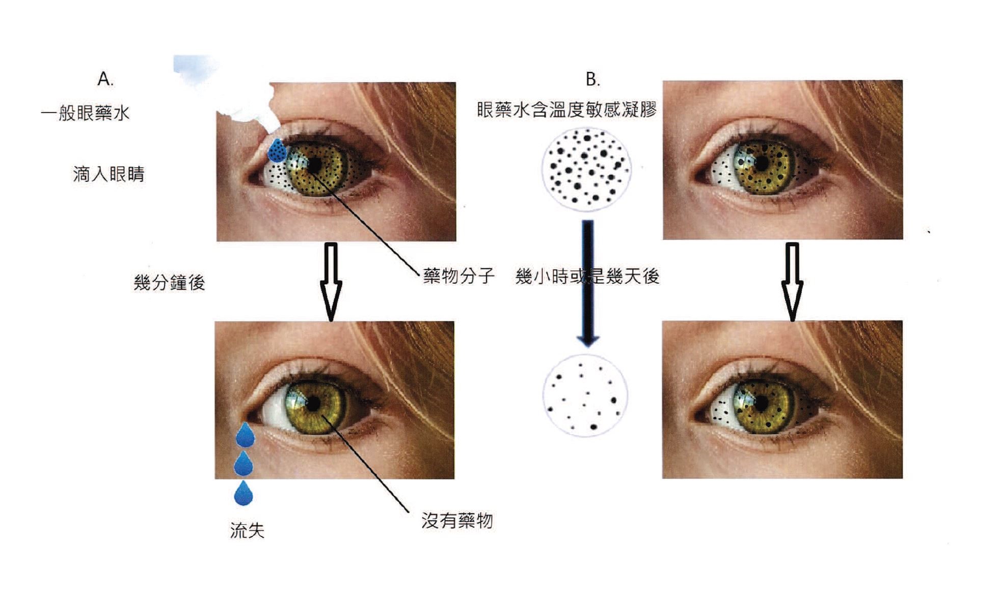 一般眼藥水在眼中停留時間短，而含溫度敏感凝膠的眼藥水，黏附時間較長，提升藥物的治療效率。（圖／余建志教授提供）