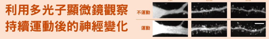 運動後，大腦的神經細胞不只變粗，軸突也因為長出新分支，在畫面中看似毛線。（圖／郭余民提供)
