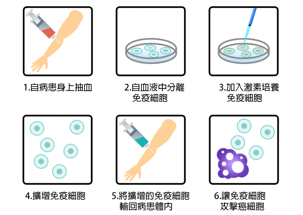 免疫細胞的細胞治療，先抽取病患自身的血液、癌細胞切片，透過體外培養的方式培養自然殺手（NK）等免疫細胞，再將大量的免疫細胞輸回病患體內，讓其消滅癌細胞。（圖／義守大學ISU科轉團隊繪製）